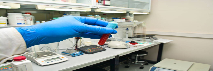 溶血性鏈球菌檢測(cè)